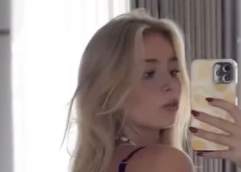 OEPS: Danique Hosmar heeft te lang op haar buik gelegen en is een beetje verbrand